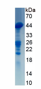 Recombinant Histone Deacetylase 7 (HDAC7)