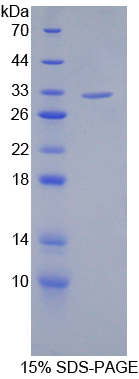 Recombinant Sirtuin 3 (SIRT3)