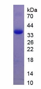 Recombinant Sirtuin 4 (SIRT4)