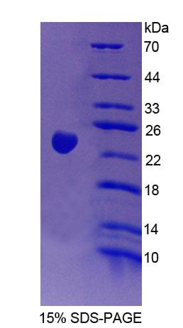 Recombinant Vav 3 Oncogene (VAV3)