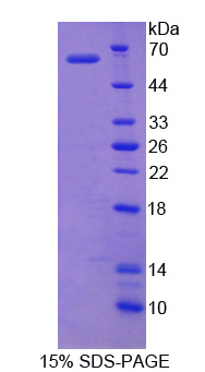 Recombinant Ubiquitin Specific Peptidase 14 (USP14)