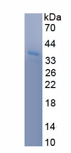 Recombinant 17-Beta-Hydroxysteroid Dehydrogenase Type 3 (HSD17b3)