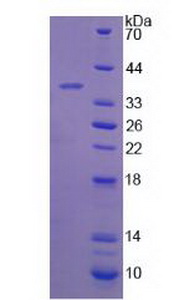 Recombinant 17-Beta-Hydroxysteroid Dehydrogenase Type 12 (HSD17b12)