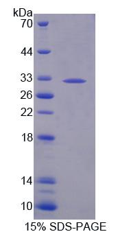 Recombinant Beta-1,3-Glucuronyltransferase 2 (b3GAT2)