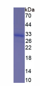 Recombinant Breast Carcinoma Amplified Sequence 2 (BCAS2)