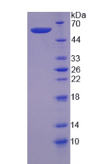 Recombinant Calpain 6 (CAPN6)