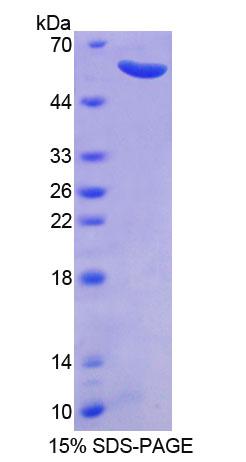 Recombinant Calpain, Small Subunit 1 (CAPNS1)