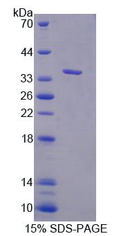 Recombinant Cancer Susceptibility Candidate 1 (CASC1)