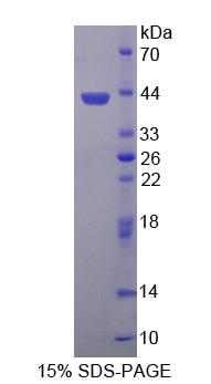 Recombinant Carbonyl Reductase 3 (CBR3)