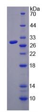 Recombinant Carboxylesterase 3 (CES3)