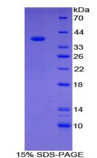 Recombinant Carboxypeptidase B1, Tissue (CPB1)