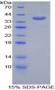 Recombinant Carboxypeptidase B1, Tissue (CPB1)