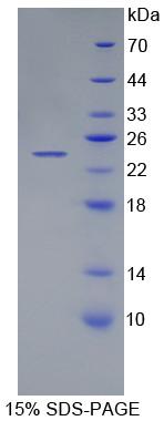 Recombinant Carnosine Dipeptidase 1 (CNDP1)