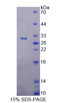 Recombinant Doublecortin Like Kinase 1 (DCLK1)