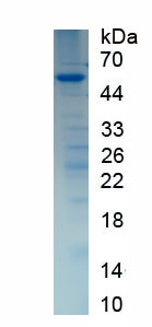 Recombinant Doublecortin Like Kinase 3 (DCLK3)