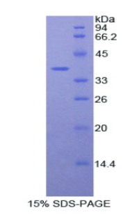 Recombinant Fibulin 4 (FBLN4)