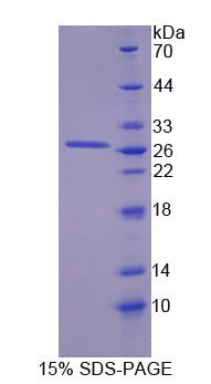 Recombinant Ferredoxin Reductase (FDXR)