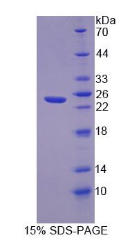 Recombinant Fibronectin Leucine Rich Transmembrane Protein 1 (FLRT1)