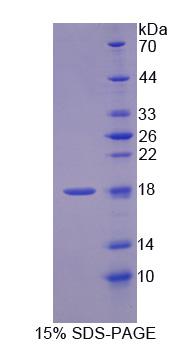 Recombinant Methylmalonyl Coenzyme A Epimerase (MCEE)