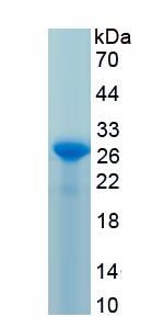 Recombinant Homeodomain Interacting Protein Kinase 2 (HIPK2)