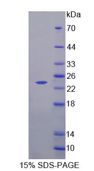 Recombinant Neurocalcin Delta (NCALd)