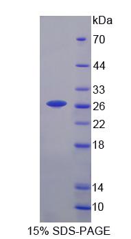 Recombinant Calsequestrin (CASQ)