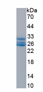 Recombinant Lamin B1 (LMNB1)