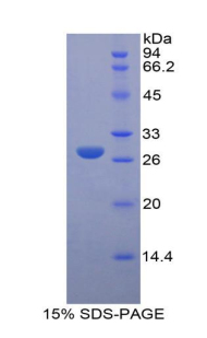 Recombinant Lysyl Oxidase Like Protein 3 (LOXL3)