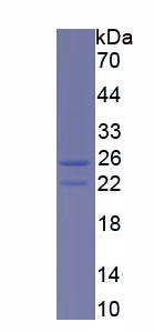 Recombinant Uridine Cytidine Kinase 1 (UCK1)