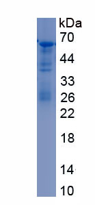 Recombinant Vaccinia Related Kinase 2 (VRK2)