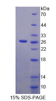 Recombinant Multimerin 2 (MMRN2)