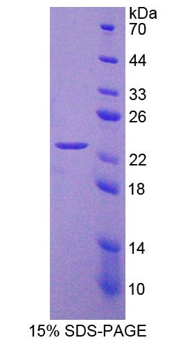 Recombinant Myotubularin Related Protein 9 (MTMR9)