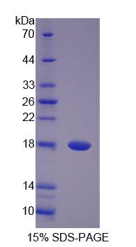 Recombinant Pantothenate Kinase 4 (PANK4)