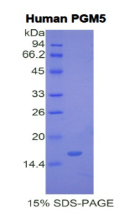 Recombinant Phosphoglucomutase 5 (PGM5)