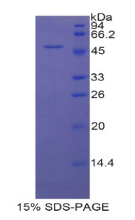 Recombinant Peroxiredoxin 3 (PRDX3)