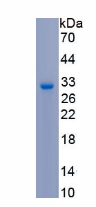 Recombinant Peroxiredoxin 4 (PRDX4)