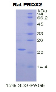 Recombinant Peroxiredoxin 2 (PRDX2)