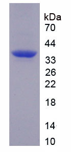 Recombinant Tumor Necrosis Factor Alpha Induced Protein 3 Interacting Protein 2 (TNIP2)