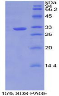 Recombinant Tumor Necrosis Factor Alpha Induced Protein 3 Interacting Protein 2 (TNIP2)