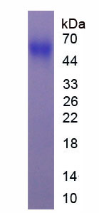 Recombinant Phosphatase And Tensin Homolog (PTEN)