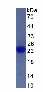 Recombinant Dual Specificity Phosphatase 3 (DUSP3)