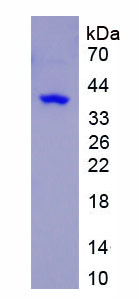 Recombinant Phenylalanyl tRNA Synthetase Beta (FARSb)