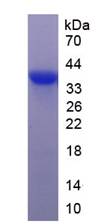 Recombinant Isoleucyl tRNA Synthetase 2, Mitochondrial (IARS2)