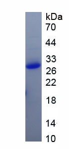 Recombinant Seryl tRNA Synthetase 2, Mitochondrial (SARS2)