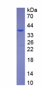 Recombinant Cysteinyl tRNA Synthetase 2, Mitochondrial (CARS2)