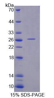 Recombinant Aspartate Beta Hydroxylase (ASPH)