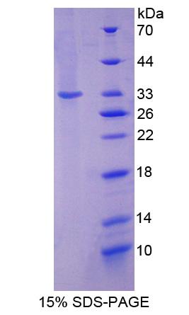 Recombinant N-Acetyltransferase 1 (NAT1)