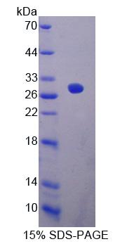 Recombinant Epithelial Stromal Interaction 1, Breast (EPSTI1)