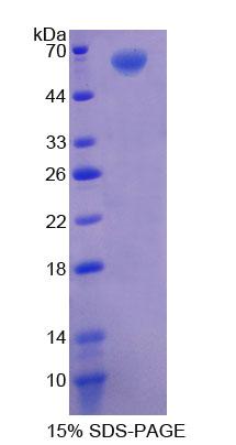 Recombinant Acylglycerol Kinase (AGK)