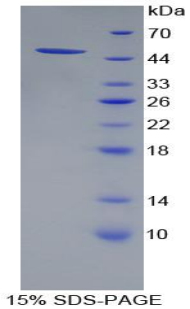 Recombinant Proteasome 26S Subunit, ATPase 4 (PSMC4)